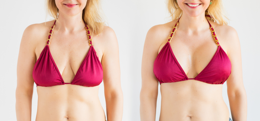 Choosing the Right Surgeon for Breast Augmentation Tips and Considerations | Soler Cosmetic Plastic Surgery